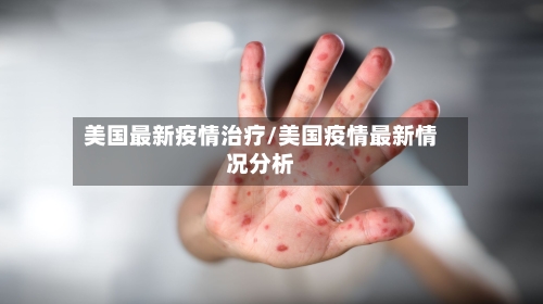 美国最新疫情治疗/美国疫情最新情况分析-第2张图片