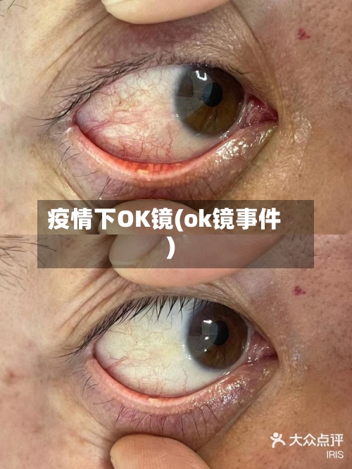疫情下OK镜(ok镜事件)