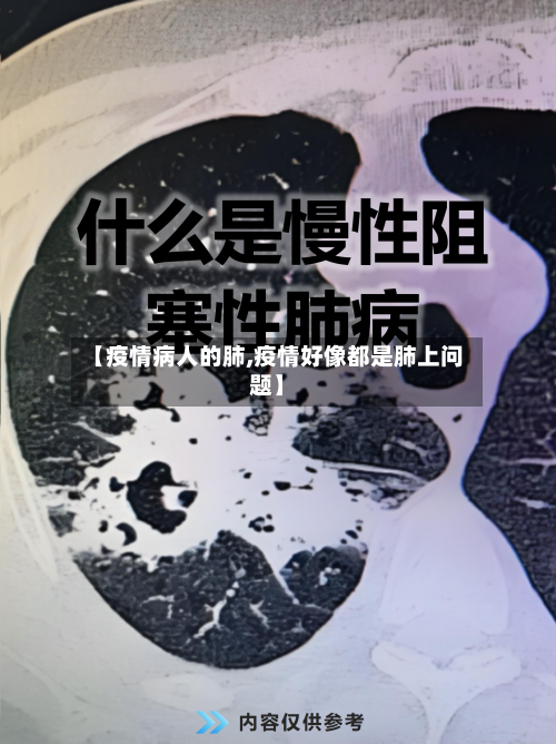 【疫情病人的肺,疫情好像都是肺上问题】